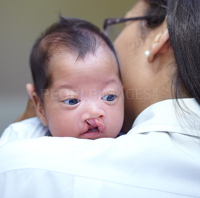 Buy stock photo Medical, cleft lip and a pediatrician with a baby in the hospital for insurance, care or treatment. Healthcare, children and a doctor woman holding a newborn with a disability in a health clinic