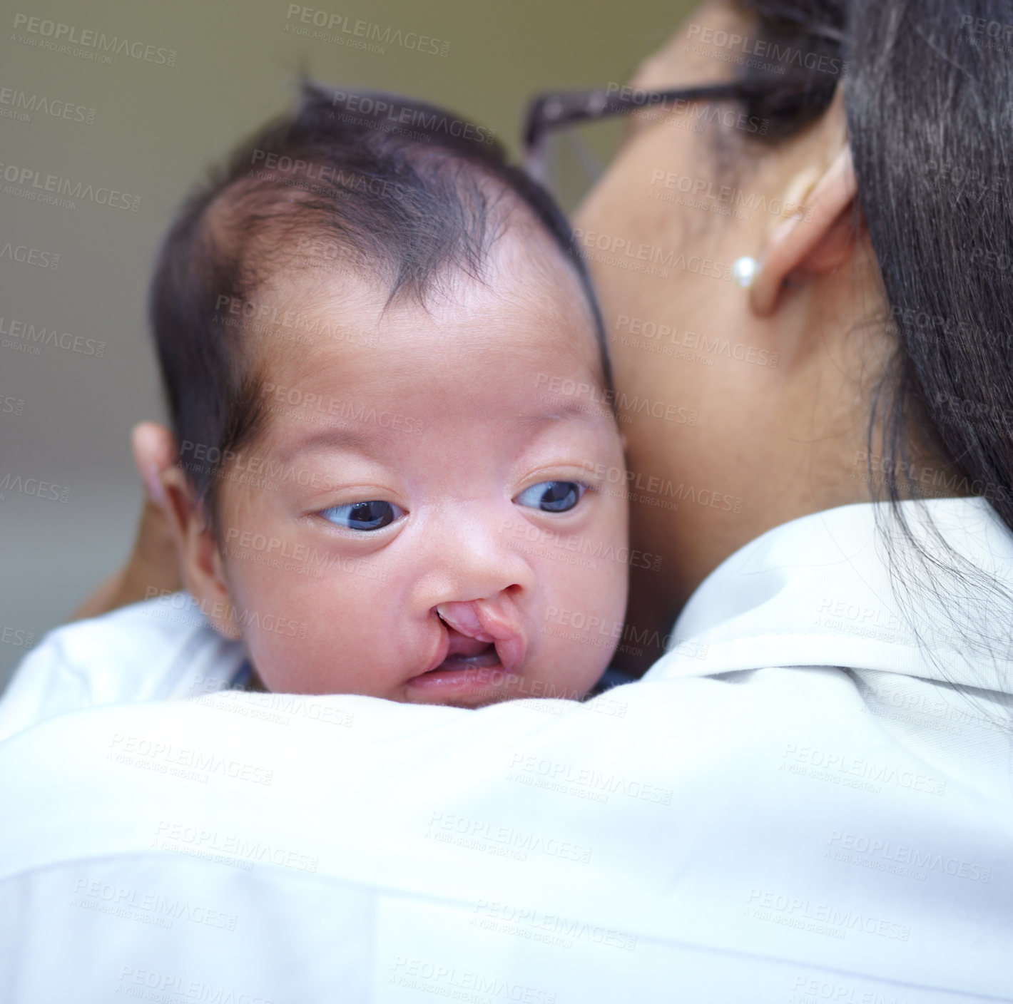 Buy stock photo Medical, cleft lip and a pediatrician with a baby in the hospital for insurance, care or treatment. Healthcare, children and a doctor woman holding a newborn with a disability in a health clinic