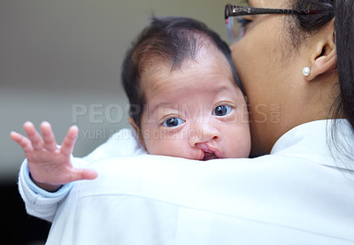 Buy stock photo Portrait of a baby girl who has a cleft palate looking over the shoulder of her mother
