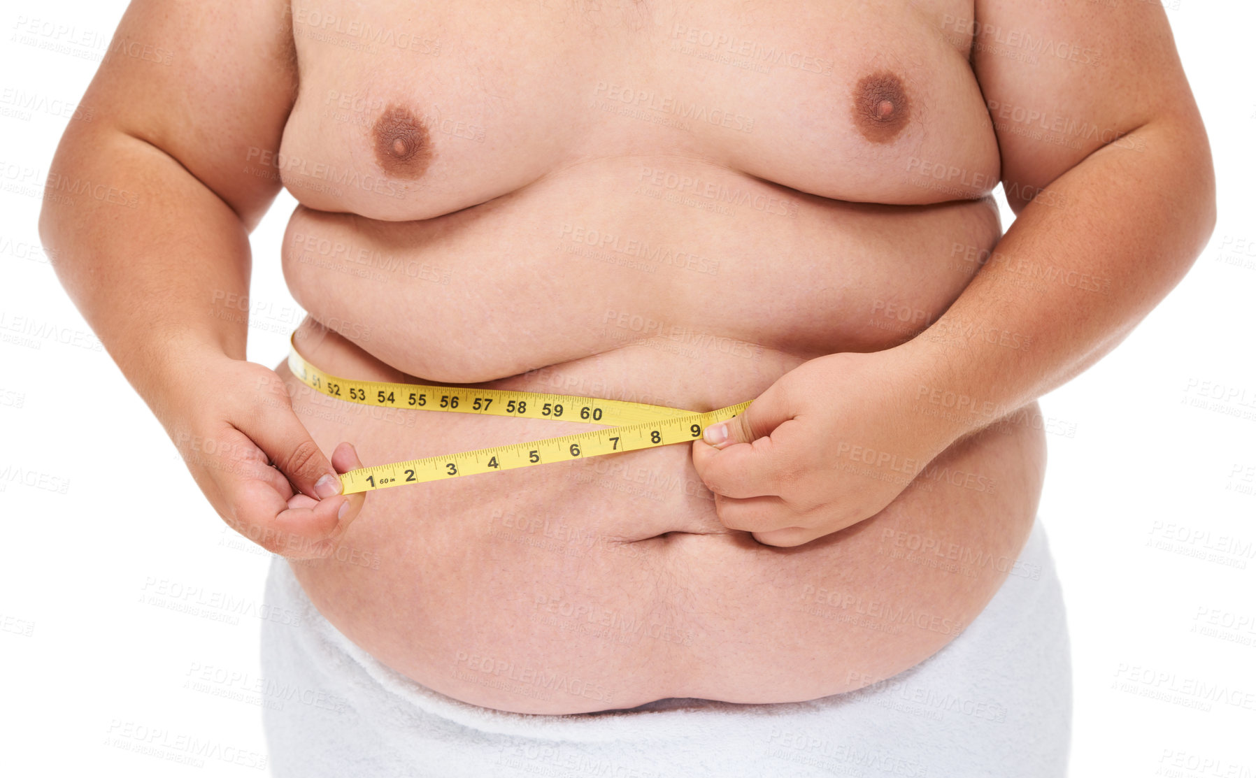 Увеличение массы тела ребенка. Сахарный диабет 2 типа ожирение.