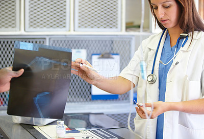 Buy stock photo Woman, veterinarian and doctor with xray at animal shelter for examination, tests or diagnosis on injury at vet. Female person, nurse or medical pet professional receiving CT scan or MRI at clinic