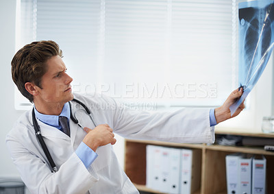 Buy stock photo Man doctor in office, review xray and health, medical diagnosis and analysis of lung scan at cardiology clinic. Radiology, assessment of results and human anatomy with surgeon, MRI and skeleton