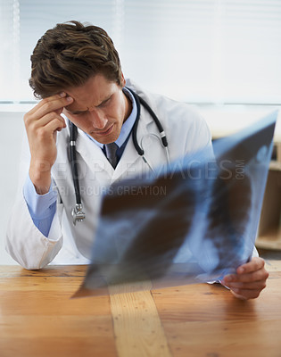 Buy stock photo Doctor, man and check xray, headache and stress in healthcare, medical diagnosis and review of lung scan at cardiology clinic. Radiology, assessment of MRI results and bad news with surgeon 