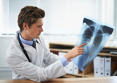 Buy stock photo Man doctor in office, analysis of xray and health, medical diagnosis and review of lung scan at cardiology clinic. Radiology, assessment of results and human anatomy with surgeon, MRI and skeleton