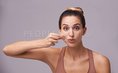 Buy stock photo Portrait of model, squeeze cheek or skincare for wellness with acne on face, breakout or scar check. Facial dermatology, studio or confident woman with pimples or beauty results on purple background