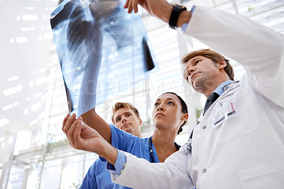 Buy stock photo A medical team looking at can xray
