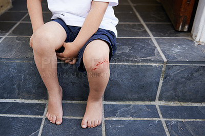 Buy stock photo A young boy sitting on a step with a cut on his knee - cropped