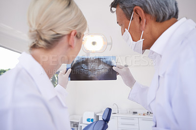 Buy stock photo Dentist, team and people with x ray for consulting, patient analysis and wellness in clinic. Healthcare, dentistry and man and woman with scan for dental hygiene, oral care and medical services