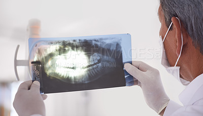 Buy stock photo Dentist, man and xray closeup of teeth for dental surgery, healthcare and oral health at clinic. Medical professional with analysis of scan, radiology and orthodontics for mouth care with treatment