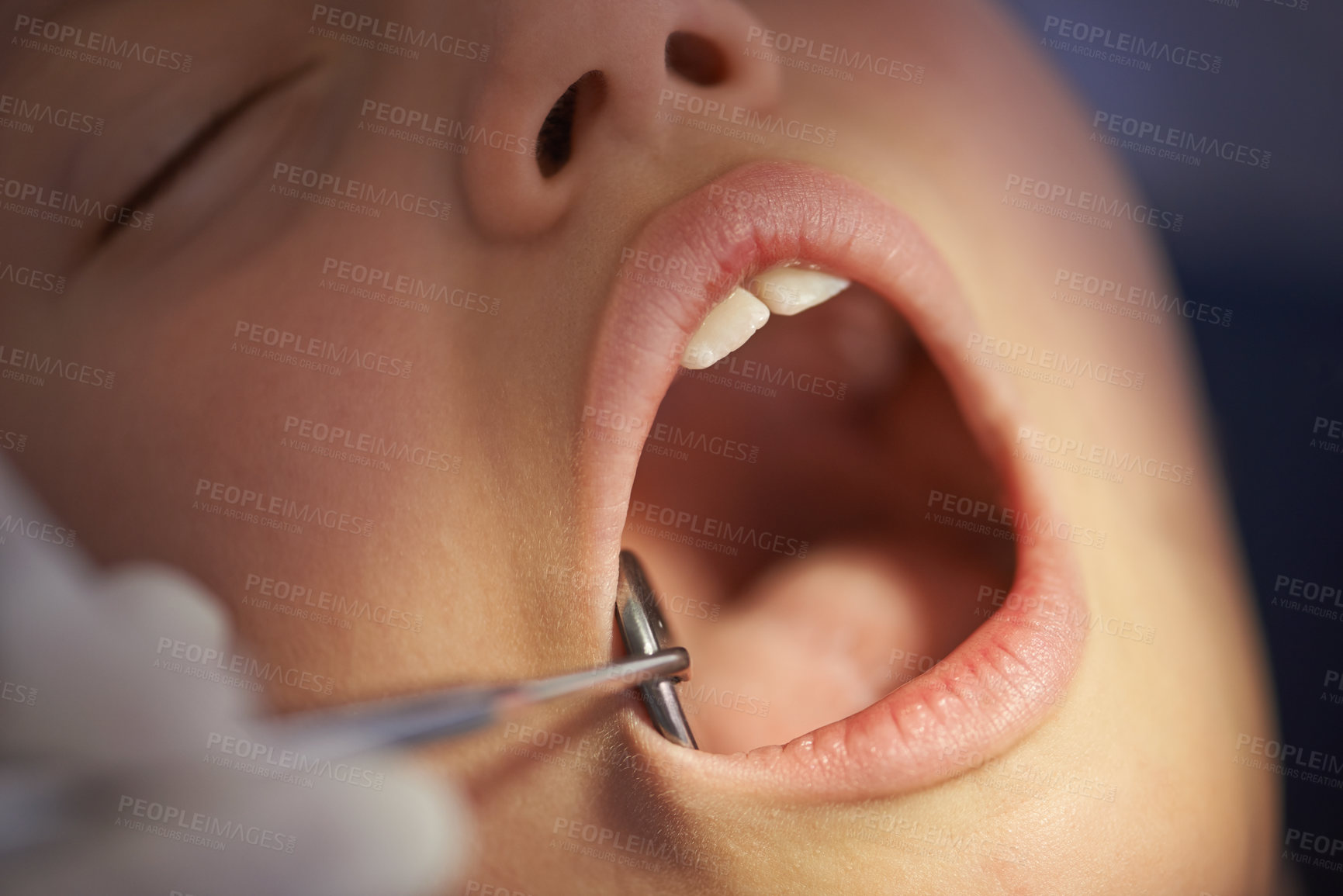 Buy stock photo Closeup, child and dentist with mirror in mouth for gum disease and oral hygiene with dental inspection. Medical, orthodontics and consultation for teeth health, cleaning and wellness with instrument