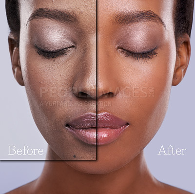 Buy stock photo Before and after concept photo of a young woman's face