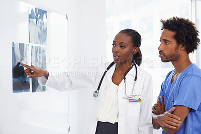 Buy stock photo Doctor, nurse and review xray for healthcare, collaboration for surgery and treatment plan with anatomy. Black people study CAT scan, MRI or radiology for medicine and surgeon with team at clinic