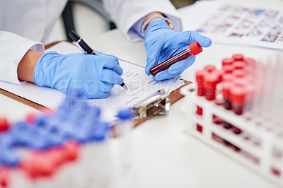 Buy stock photo Closeup shot of a scientist examining a blood sample and recording findings in a lab