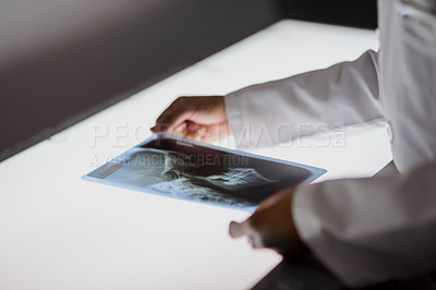 Buy stock photo Closeup shot of an unrecognisable dentist analysing an x-ray