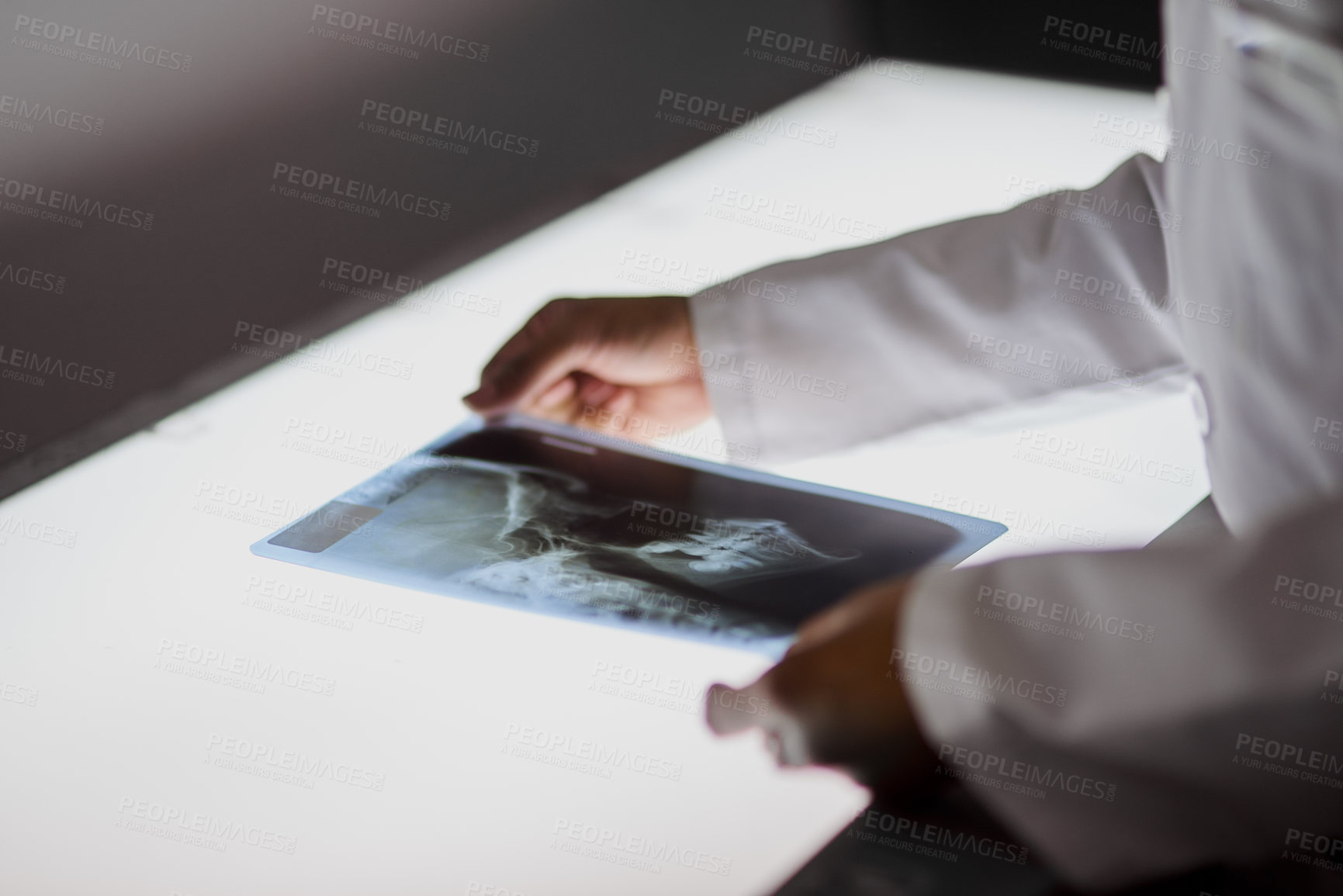 Buy stock photo Dentist, hands and analyse x ray in office, radiography table and examine skeletal structure with orthodontist for jaw placement. Assessment, professional and oral health, dentistry and implant scan