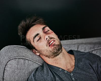 Buy stock photo Cropped shot of a beaten and bruised young man sleeping on the sofa