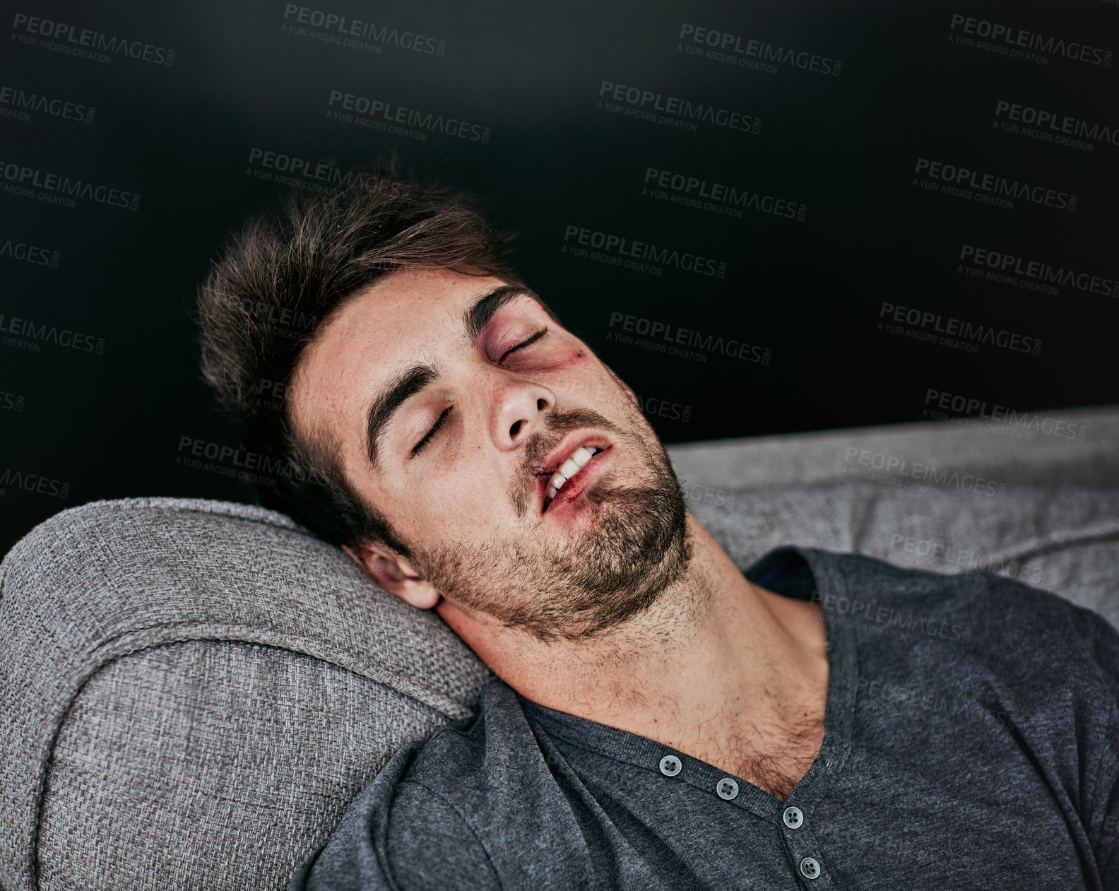 Buy stock photo Cropped shot of a beaten and bruised young man sleeping on the sofa