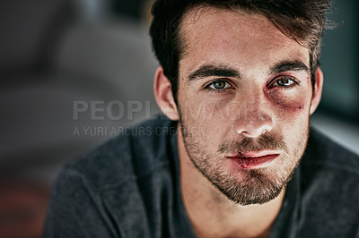 Buy stock photo Cropped portrait of a beaten and bruised young man looking down