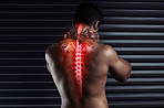 You don't push through spinal pain