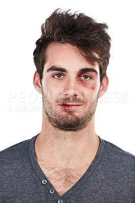 Buy stock photo Portrait, man and abuse victim in studio, hurt and bruise, conflict and fight on white background. Face, male and facial injury, black eye and wound, domestic violence and scratches while isolated