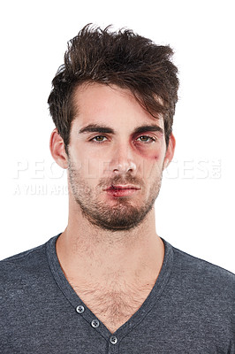 Buy stock photo Portrait, injury and man with black eye in studio for bruise, blood and conflict in white background. Face, wound and male after domestic abuse attack, crisis and danger while standing isolated