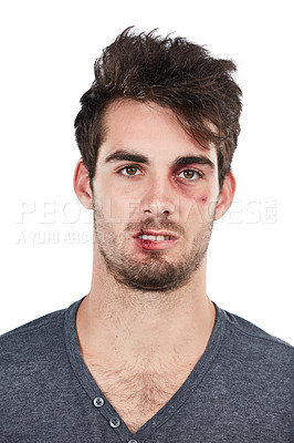 Buy stock photo Face, injury and portrait of man in studio for black eye, abuse victim and fight, conflict or bruise on white background. Portrait, domestic violence and facial wound on male, blood and isolated