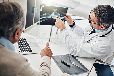 Buy stock photo Shot of a doctor and his mature patient looking at an x-ray together during a consultation