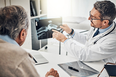 Buy stock photo Shot of a doctor and his mature patient looking at an x-ray together during a consultation