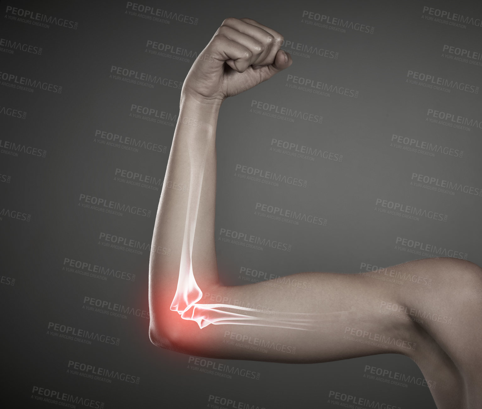 Buy stock photo Woman, arm pain and x ray of injury in studio, training accident and red glow on gray background. Female person, flex and joint arthritis or risk of fibromyalgia, overlay and inflammation of elbow