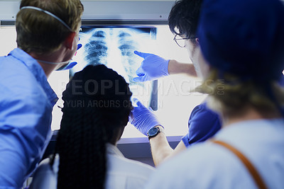 Buy stock photo Shot of a team of surgeons discussing a patient’s x rays during surgery