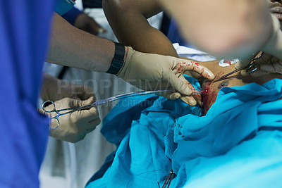 Buy stock photo Cropped shot of a doctor inserting a tube into a patient’s chest in an emergency room