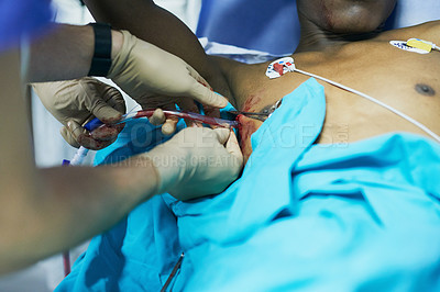 Buy stock photo Cropped shot of a doctor inserting a tube into a patient’s chest in an emergency room