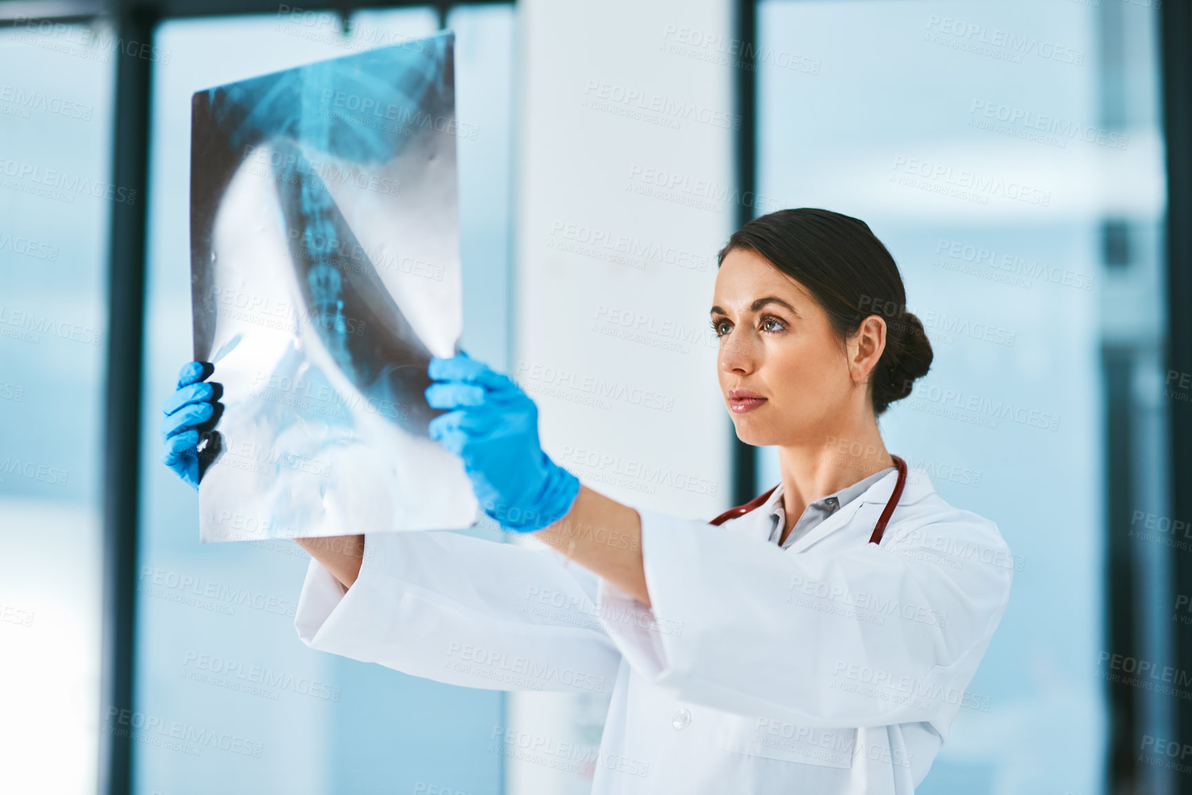 Buy stock photo Doctor, woman and x ray for diagnosis in hospital, analysis and check results of patient MRI. Female person, research and scan of spine or assessment, healthcare and consulting or study for anatomy