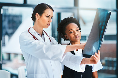 Buy stock photo Doctor, team and x ray for diagnosis in hospital, analysis and check results of patient MRI. People, collaboration and CT scan of spine or assessment, healthcare and consulting or study for medical