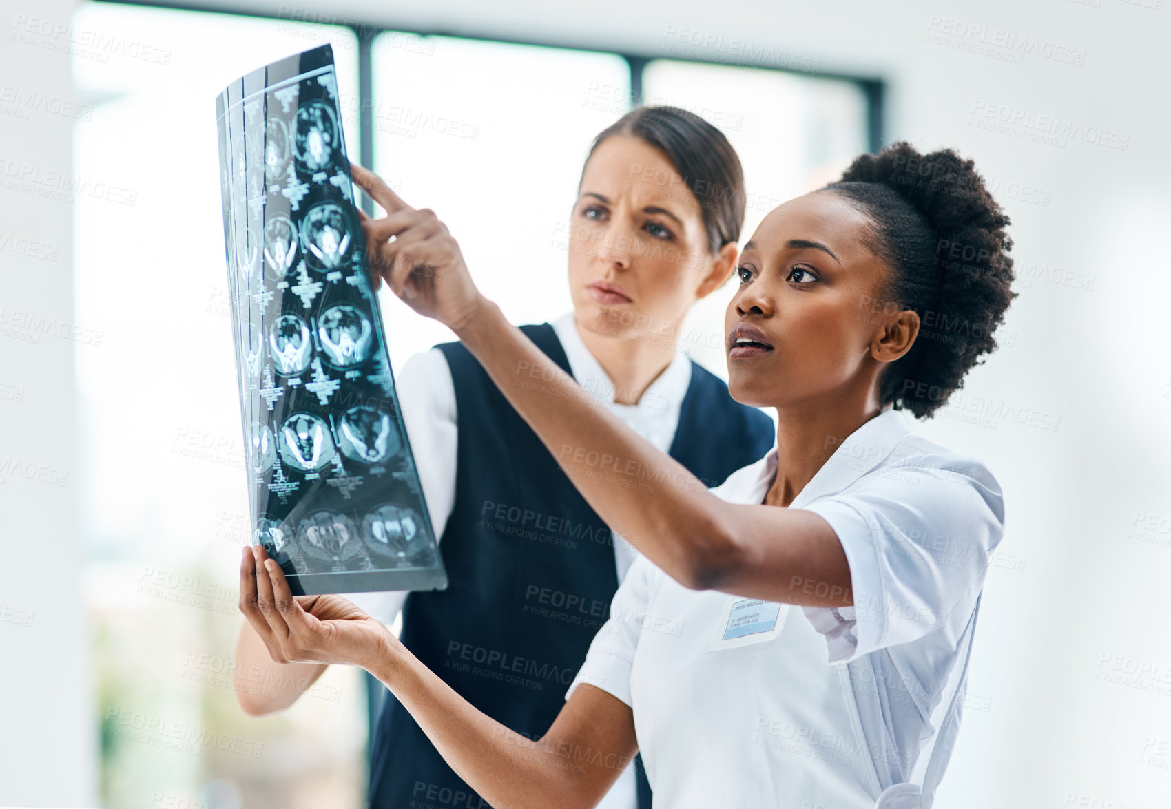 Buy stock photo Hospital, teamwork and women doctors with brain scan for review, diagnosis or consultation. Healthcare, neurology and medical MRI results with professional collaboration, advice and nurse at clinic