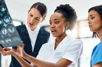 Buy stock photo Hospital, team and doctors checking MRI results for diagnosis, advice or consultation with smile. Healthcare, neurology and brain scan review with medical professional, woman and nurse at clinic.