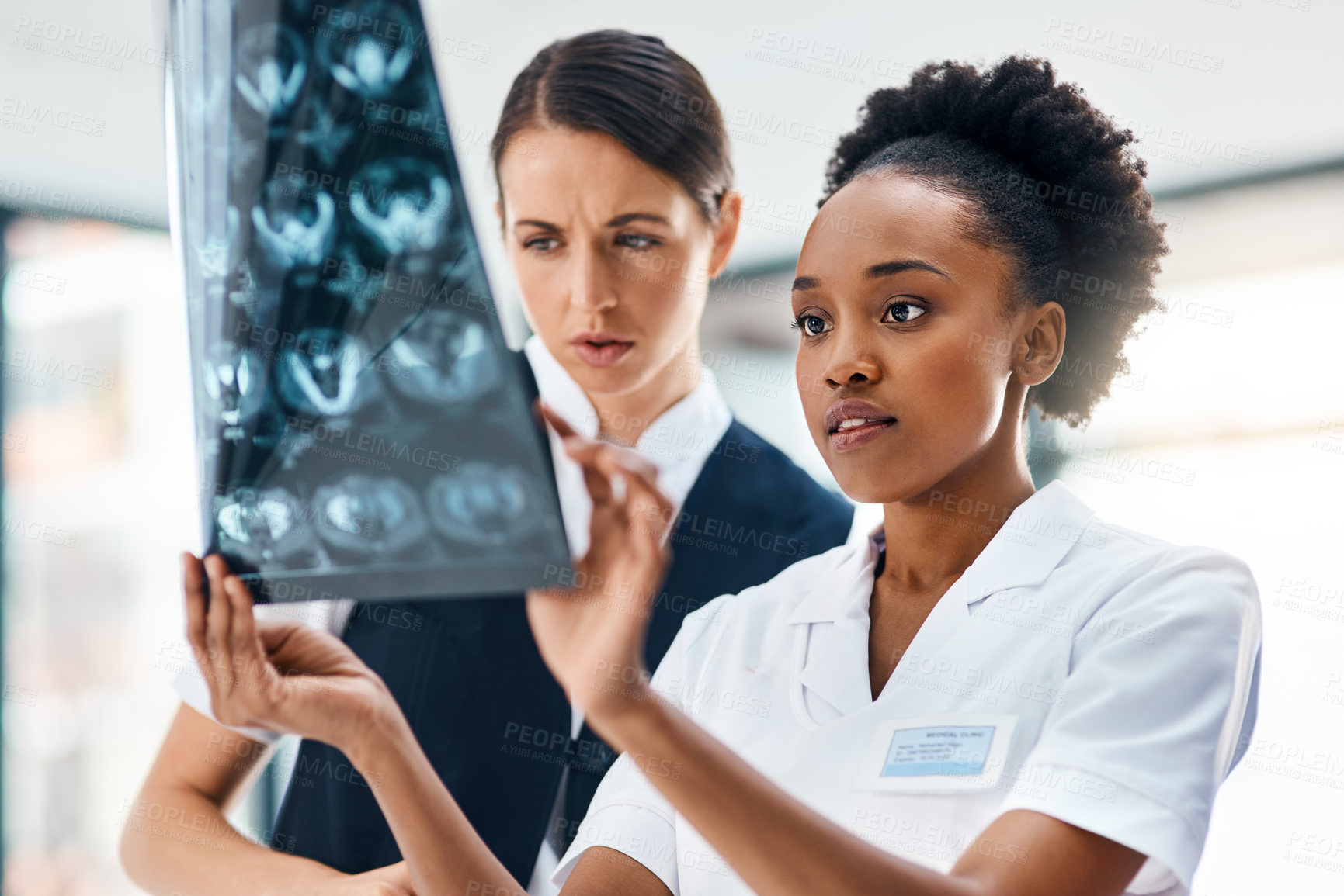 Buy stock photo Hospital, team and women doctors with MRI scan for review, diagnosis or X-ray consultation. Healthcare, neurology and medical results with professional collaboration, advice and nurse at braIn clinic