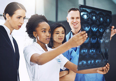 Buy stock photo Teamwork, nurse and surgery with doctors and xray for medical results, help or support. Radiography, healthcare and medicine with people consulting in hospital for planning, expert and x ray review