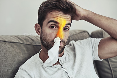 Buy stock photo Portrait of a unhappy young man wearing a tissue in his nose due to sinus related problems