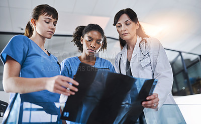 Buy stock photo Shot of a group of doctors discussing the results of an X-ray in a hospital