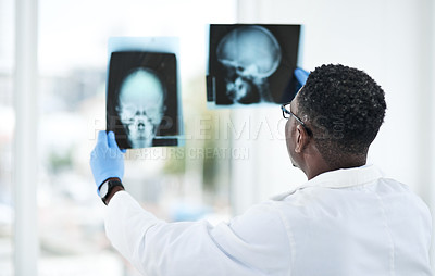 Buy stock photo Shot of a young doctor analysing an x ray of a patient’s skull