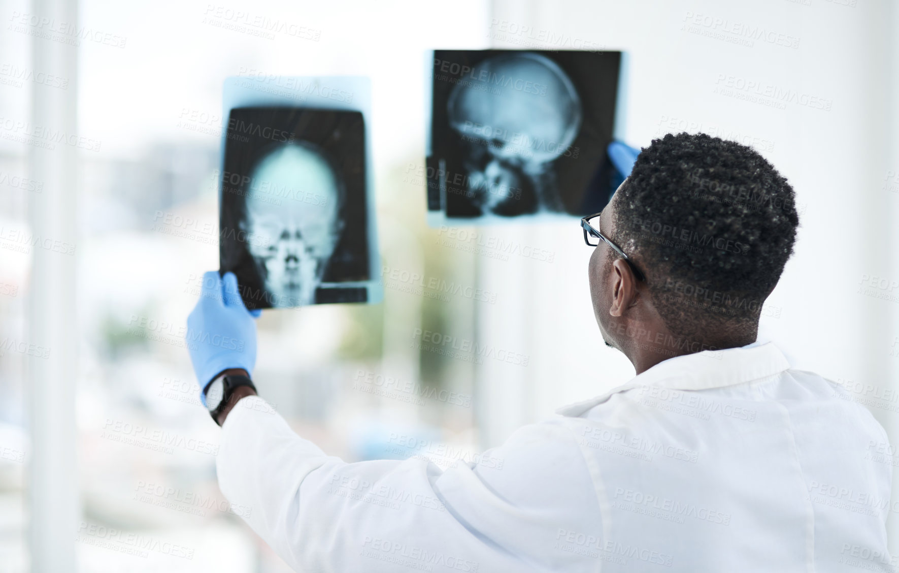 Buy stock photo Black man, doctor and xray in clinic for healthcare, neurology or brain cancer diagnosis. Radiologist, skull image or research in hospital for surgery planning, aneurysm analysis or medical knowledge