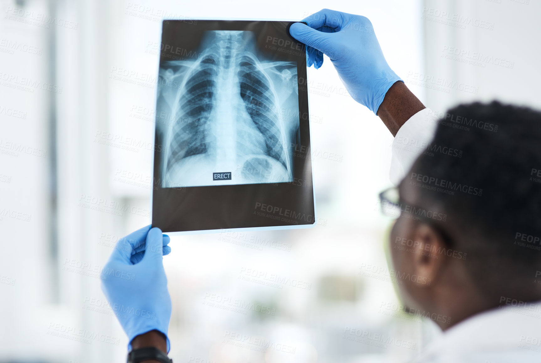 Buy stock photo Shot of a young doctor analysing an x ray of a patient’s chest