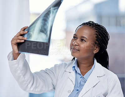 Buy stock photo Shot of a young doctor analysing an x-ray in a hospital