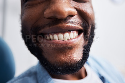 Buy stock photo Shot of an unrecognisable smiling brightly after having had dental work done
