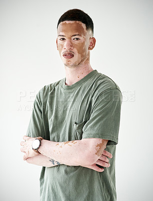 Buy stock photo Fashion, portrait and man with vitiligo on skin with confidence and pride in background of studio. Natural, beauty and person with arms crossed for unique dermatology, treatment and gen z style