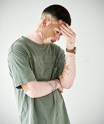 Buy stock photo Studio shot of a young man with vitiligo looking upset against a white background