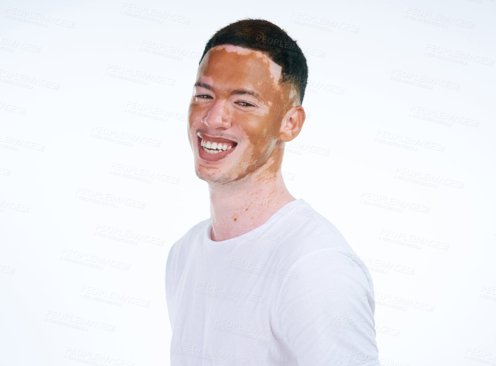 Buy stock photo Happy, handsome and portrait of man with vitiligo or skin pigmentation on a white studio background. Face of unique and confident male person or albino with smile for melanin condition or mixed tone