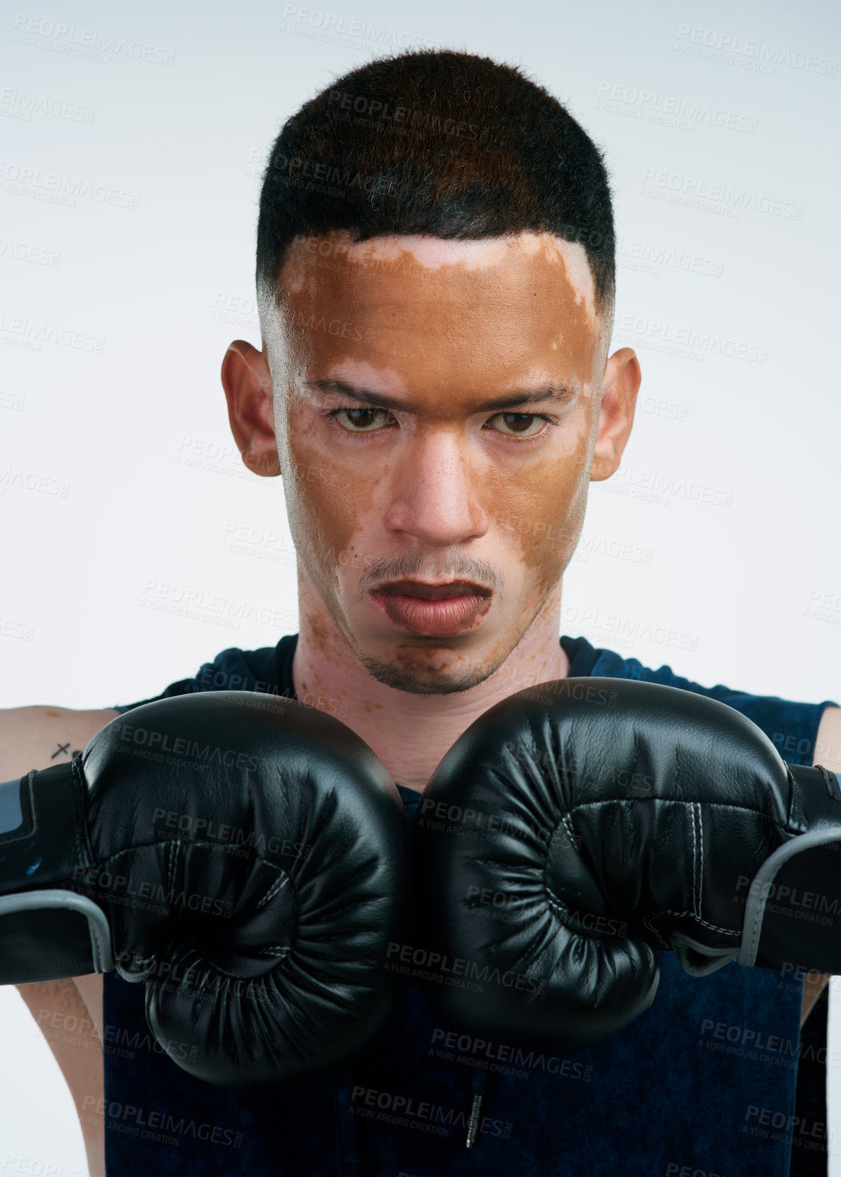 Buy stock photo Portrait shot of a handsome young male boxer with vitiligo posing in studio