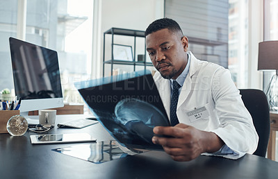 Buy stock photo Shot of a young doctor examining an x-ray in an office